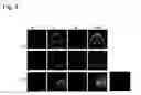 Fig. 10 - Method of full-color optical coherence tomography