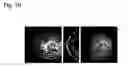 Fig. 11 - Method of full-color optical coherence tomography