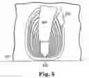 Fig. 04 - Magnetoresistive/inductive write head assembly formed with seed layers having a uniform thickness