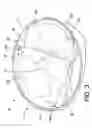 Fig. 03 - Off-axis parabolic reflector