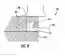 Fig. 04 - Extrusion auger with removable auger segments and removal tool