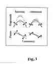 Fig. 02 - Method for correcting sound for the hearing-impaired