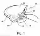 Fig. 02 - Tangential stress reduction system in a loudspeaker suspension