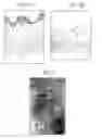 Fig. 02 - Skin decellularization method, acellular dermal matrix and production method therefore employing said decellularization method, and composite cultured skin employing said matrix