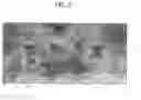 Fig. 06 - Skin decellularization method, acellular dermal matrix and production method therefore employing said decellularization method, and composite cultured skin employing said matrix
