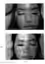 Fig. 03 - Tea for treating dermatitis comprising herbal extracts