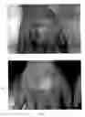 Fig. 04 - Tea for treating dermatitis comprising herbal extracts
