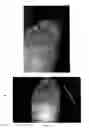 Fig. 07 - Tea for treating dermatitis comprising herbal extracts
