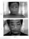 Fig. 08 - Tea for treating dermatitis comprising herbal extracts
