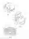 Fig. 02 - Two-part orthodontic bracket