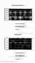Fig. 08 - Methods and systems for enabling and stabilizing tooth movement