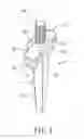 Fig. 02 - Positioning needle used in denture mold for positioning denture in plaster cast and denture mold matched with the positioning needle