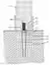 Fig. 01 - Assembly of positioning needle and denture mold for positioning denture in plaster cast of the denture mold