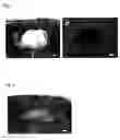 Fig. 04 - Method of constructing spinal injury model monkey and utilization thereof