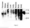 Fig. 07 - Compositions and methods of using hexokinase V