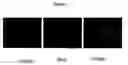 Fig. 09 - Compositions and methods of using hexokinase V