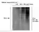 Fig. 01 - Method for screening a substance which can suppress degradation of a nuclear receptor or a substance which can promote degradation of a nuclear receptor