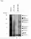 Fig. 06 - Method for screening a substance which can suppress degradation of a nuclear receptor or a substance which can promote degradation of a nuclear receptor