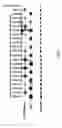 Fig. 04 - Method of treating neurodegenerative disease