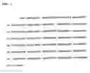 Fig. 07 - Human procalcitonin and the preparation and use thereof