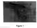 Fig. 02 - Tissue system with undifferentiated stem cells derived from corneal limbus