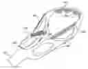 Fig. 01 - Multi-component lacrosse stick head