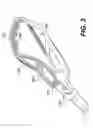 Fig. 09 - Multi-component lacrosse stick head