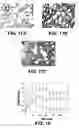 Fig. 16 - Albumin-based colloid composition having at least one protected thiol region, methods of making, and methods of use