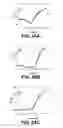 Fig. 20 - Albumin-based colloid composition having at least one protected thiol region, methods of making, and methods of use