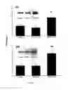 Fig. 16 - Uridine administration improves phosphatide synthesis, synaptic transmission and cognitive function