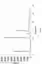 Fig. 09 - Crystalline forms of temozolomide