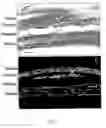 Fig. 03 - Method of inhibiting choroidal neovascularization