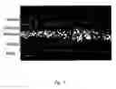 Fig. 04 - Method of inhibiting choroidal neovascularization
