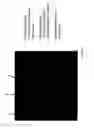 Fig. 02 - Methods and compositions comprising non-peptide small molecules that solubilize the alzheimer's Abeta peptide fiber
