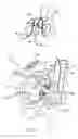 Fig. 02 - Left ventricular function assist system and method
