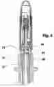 Fig. 09 - Intra-urethral sphincter and method and means for anchoring it in a urethra
