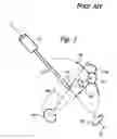Fig. 02 - Global endoscopic viewing indicator