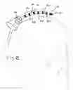 Fig. 06 - Electrophysiology/ablation catheter having second passage