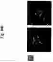 Fig. 22 - Apparatus and method for displaying sectional planes of target object utilizing 3-dimensional ultrasound data
