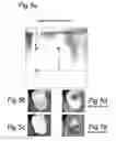 Fig. 06 - Laser doppler perfusion imaging with a plurality of beams