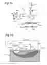 Fig. 08 - Laser doppler perfusion imaging with a plurality of beams