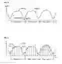 Fig. 04 - Real-time measurement of ventricular stroke volume variations by continuous arterial pulse contour analysis