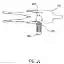Fig. 20 - Implantable wireless sensor