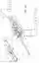 Fig. 03 - Electrosurgical specimen-collection system