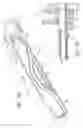 Fig. 09 - Electrosurgical specimen-collection system
