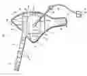 Fig. 01 - Compression apparatus