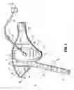 Fig. 02 - Compression apparatus
