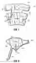 Fig. 06 - Compression treatment system
