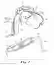 Fig. 03 - Cervical collar utilizing laminated members