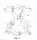 Fig. 04 - Cervical collar utilizing laminated members